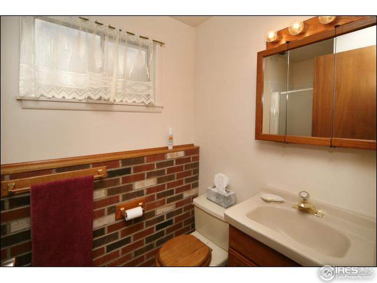 836 West Prospect Road Fort Collins, CO 80521 - Photo 10 of 15 Gallery Image 10