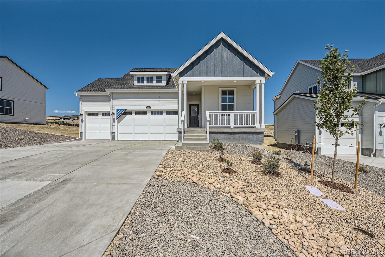 39523 Penn Road Elizabeth, CO 80107 - Photo 1 of 20 Gallery Image 1
